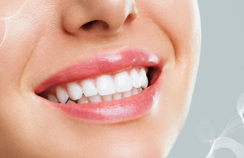 Limpeza Dental (Profilaxia)